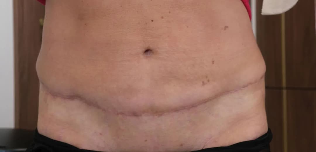 Sennik Operacja Brzucha - Sen o Operacji i Sennik Operacja Oczu