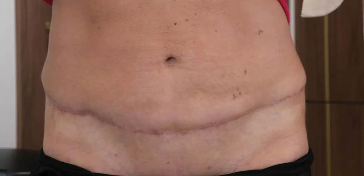 Sennik Operacja Brzucha - Sen o Operacji i Sennik Operacja Oczu